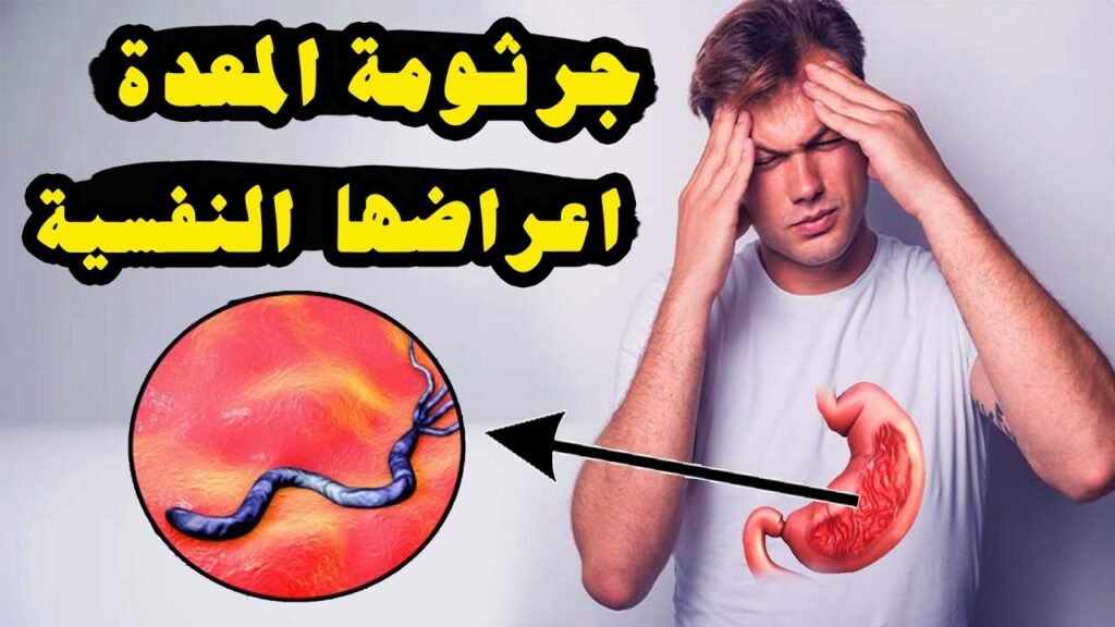 اعراض جرثومة المعدة